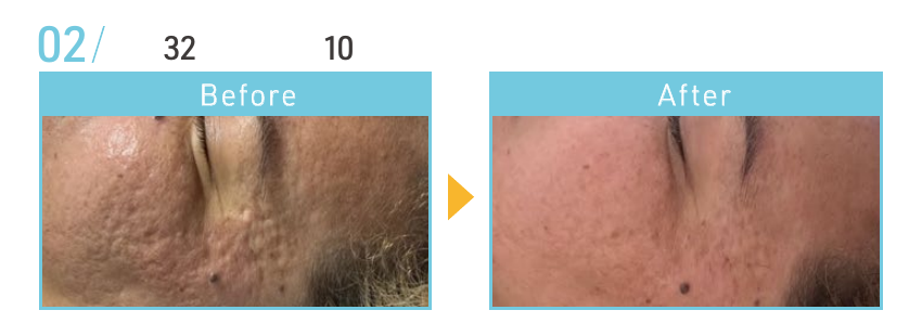 資料記載なし(写真参照)のBeforeとAfterの施術例
