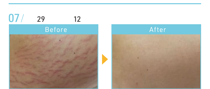 資料記載なし(写真参照)のBeforeとAfterの施術例