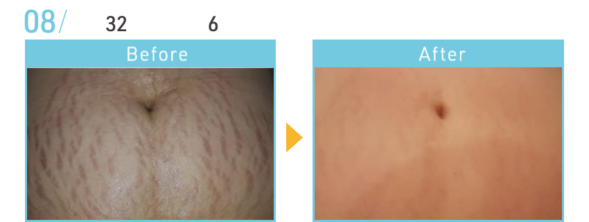 資料記載なし(写真参照)のBeforeとAfterの施術例
