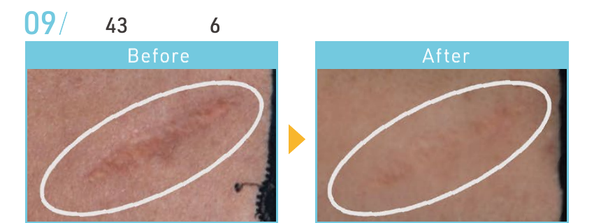 資料記載なし(写真参照)のBeforeとAfterの施術例