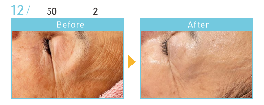 資料記載なし(写真参照)のBeforeとAfterの施術例